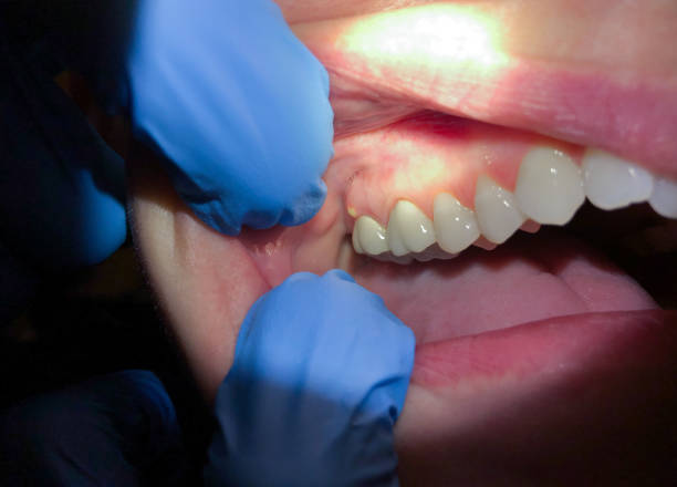 Best Emergency TMJ Treatment in La Vernia, TX