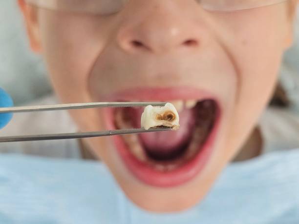 Best Emergency Gum Treatment in La Vernia, TX